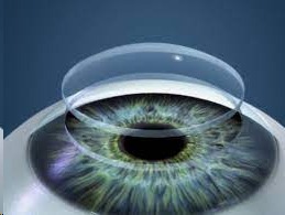 Cirurgia de C�rnea