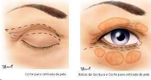 Cirurgia Oftalmoplastica